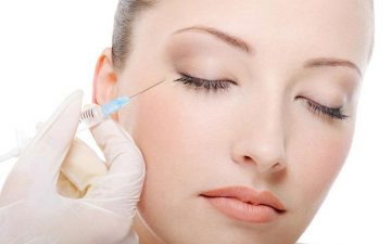 Căng da mặt bằng chỉ collagen có thực sự hiệu quả?